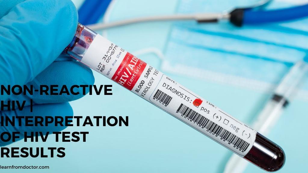 'Video thumbnail for Non-reactive HIV | Interpretation of HIV Test Results'