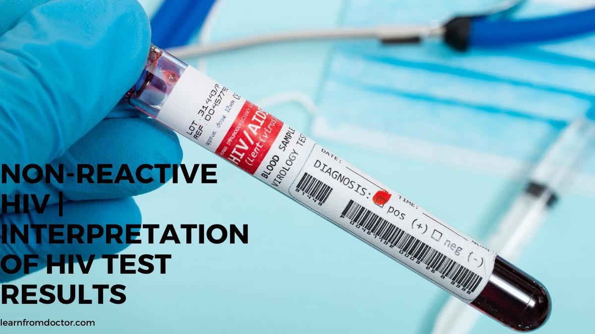 'Video thumbnail for Non-reactive HIV | Interpretation of HIV Test Results'