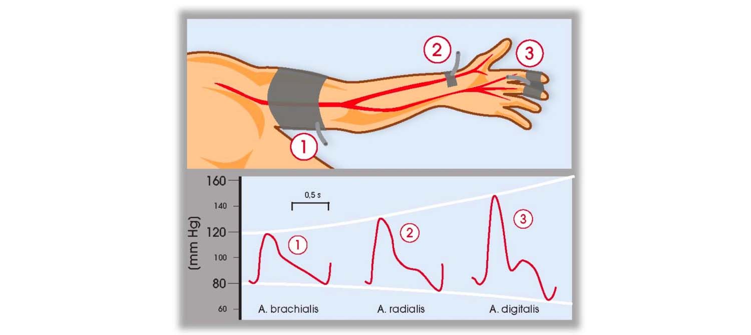 Brachial Artery Pulse Location