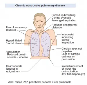 Chronic Obstructive Pulmonary Disease related with Tension Pneumothorax