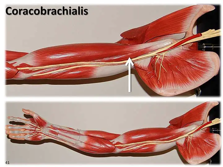 Coracobrachialis muscle labeled