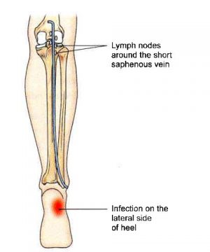 Popliteal Fossa: Complete Anatomical Overview | Learn from doctor