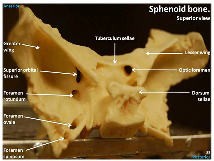 Labeled Figure of the Sphenoid Bone