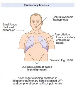 Pulmonary Fibrosis related with Tension Pneumothorax