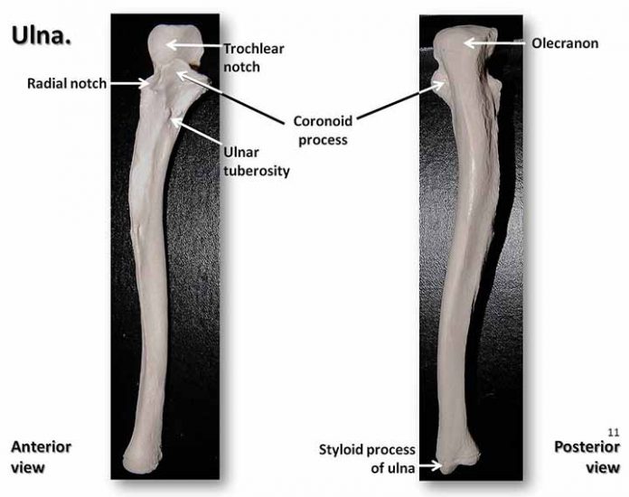 Styloid Process Temporal And Ulnar Complete Anatomy Learn From Doctor 