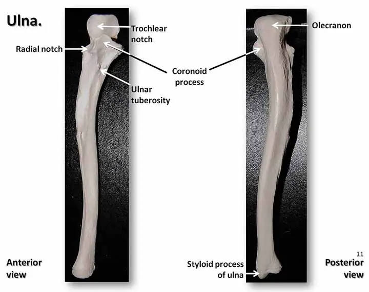 Styloid Process of ulna