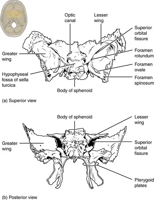 Superior and Posterior view of the Sphenoid Bone