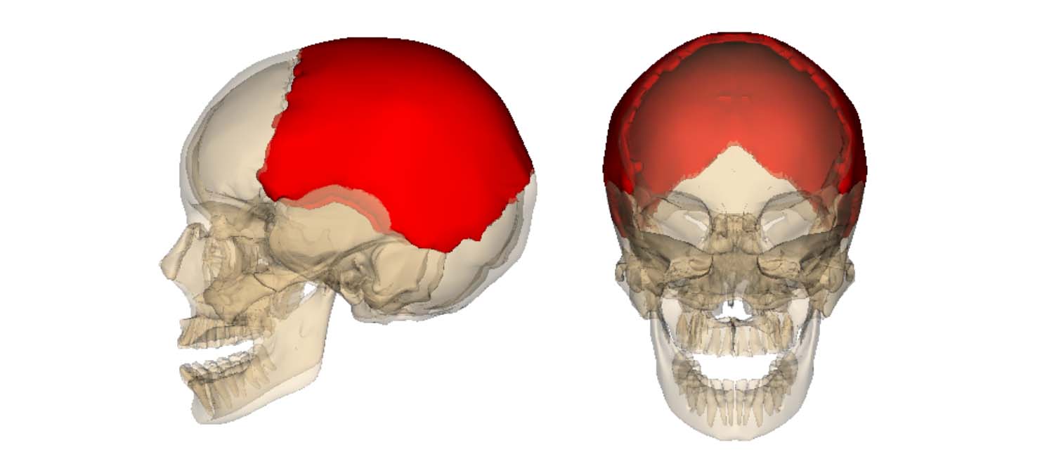 The Parietal Bone - Anatomy, Borders, Surfaces, Clinical Points