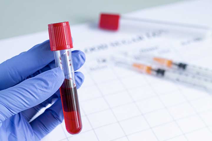blood sample for the double marker test
