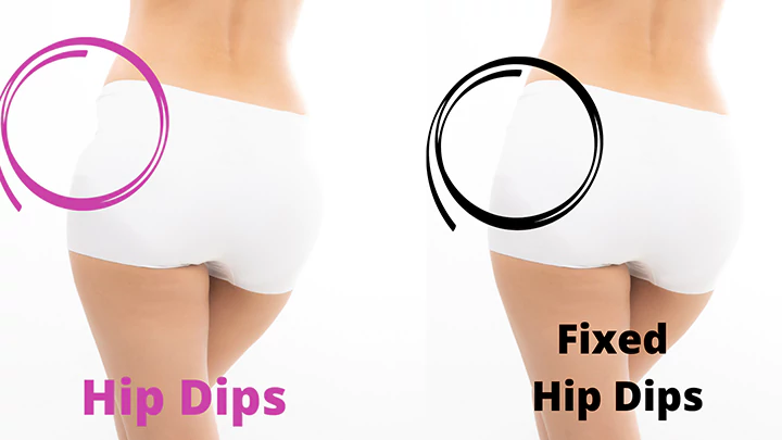 Hip Dips Explained