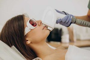 Laser hair removal in upper lip takes less than a minute