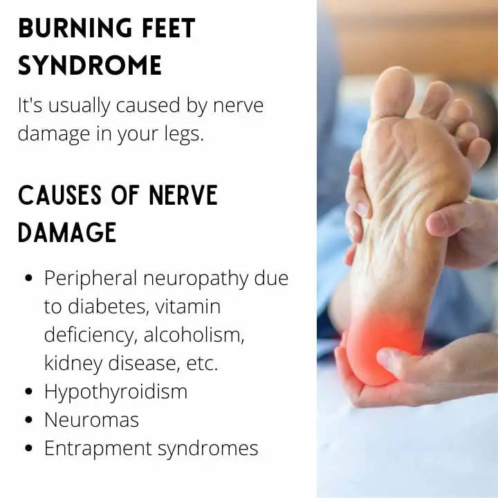 Burning Feet Syndrome Causes