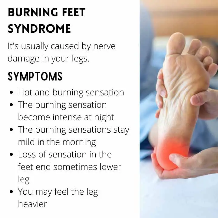Burning Feet Syndrome Symptoms