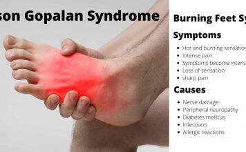 Grierson Gopalan Syndrome - Burning Feet Syndrome