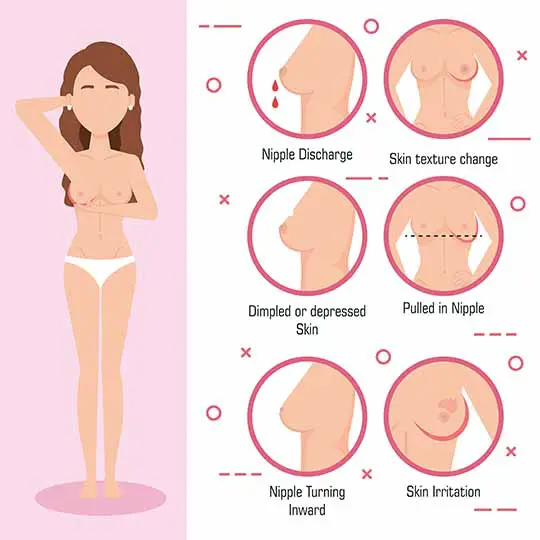 Puffy Nipples and Breast Cancer infographics
