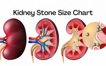 Kidney stone size chart in mm and cm