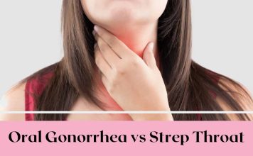 oral gonorrhea vs strep throat
