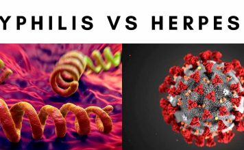 Syphilis Vs Herpes